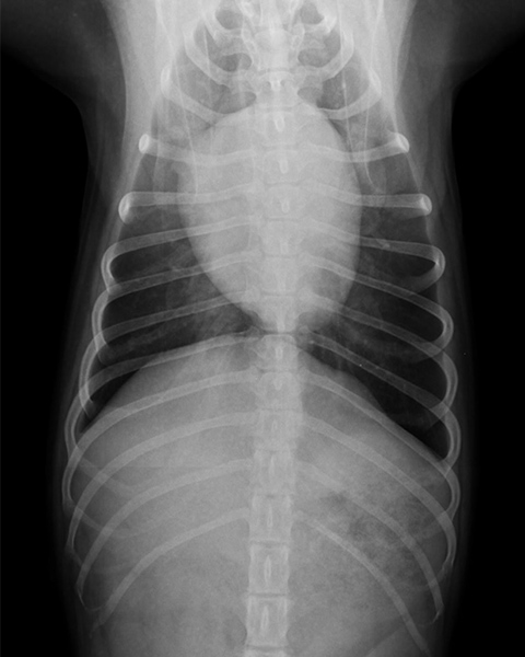 正常な胸部のレントゲン画像